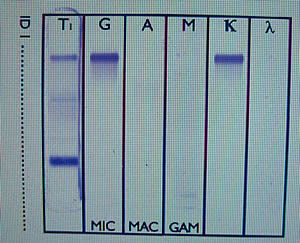 electrophoresis.jpg